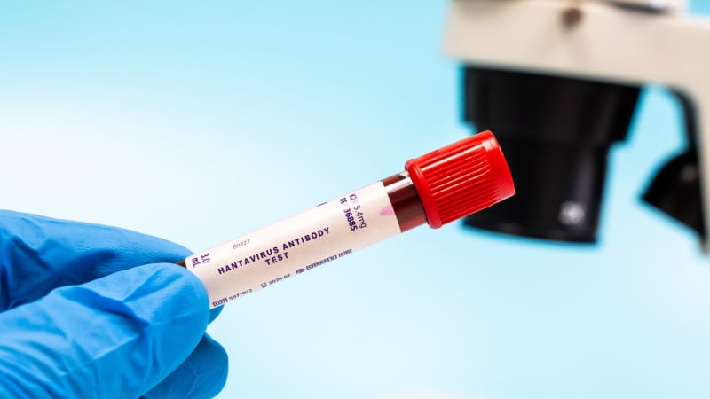 PŘEHLEDNĚ: Smrtící hantavirus zabíjí na výletní lodi. Jak se šíří a proč je tak zákeřný?